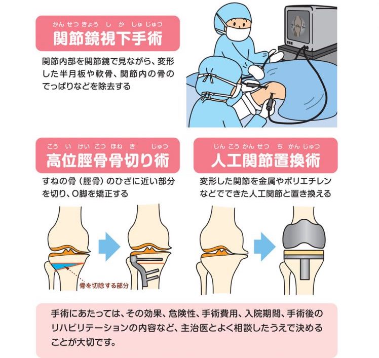 症 手術 費用 膝 関節 変形 性